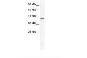 Image no. 1 for anti-Zinc Finger Protein 365 (ZNF365) (AA 33-82) antibody (ABIN202270) (ZNF365 抗体  (AA 33-82))