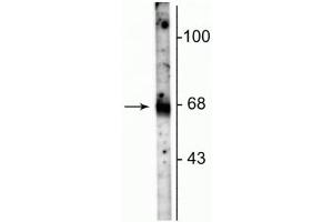 Western blot of rat hippocampal lysate showing specific immunolabeling of the ~67 kDa GAT-1 protein. (SLC6A1 抗体  (C-Term))
