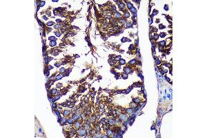 Immunohistochemistry of paraffin-embedded Mouse testis using CTNN Rabbit pAb (ABIN7266136) at dilution of 1:100 (40x lens). (CTNNA3 抗体  (AA 1-240))