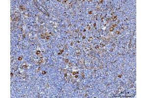 IHC analysis of Axin 2/AXIN2 using anti-Axin 2/AXIN2 antibody (ABIN7602177). (AXIN2 抗体  (AA 614-843))