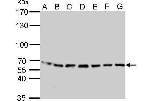 WB Image STIP1 antibody detects STIP1 protein by Western blot analysis. (STIP1 抗体)