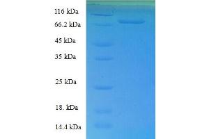 SDS-PAGE (SDS) image for Docking Protein 1, 62kDa (Downstream of tyrosine Kinase 1) (DOK1) (AA 1-481), (full length) protein (His-SUMO Tag) (ABIN5711727)