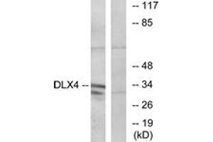 Western blot analysis of extracts from COLO cells, using DLX4 Antibody. (DLX4 抗体  (AA 61-110))