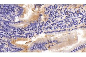 Detection of MPIF2 in Mouse Small intestine Tissue using Polyclonal Antibody to Myeloid Progenitor Inhibitory Factor 2 (MPIF2) (CCL24 抗体  (AA 27-119))
