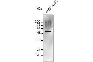 Western Blotting (WB) image for anti-Protein Phosphatase 1, Regulatory Subunit 8 (PPP1R8) antibody (ABIN7272976) (PPP1R8 抗体)