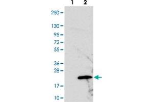 Western blot analysis of Lane 1: Negative control (vector only transfected HEK293T lysate). (PRELID2 抗体)