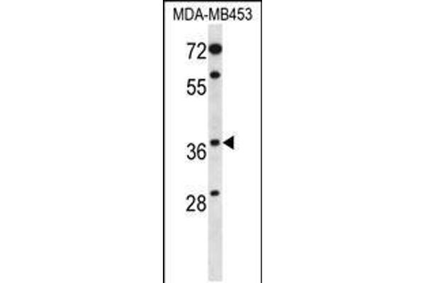 PAQR8 antibody  (C-Term)
