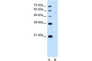 WB Suggested Antibody Titration:  2. (RSRC2 抗体  (C-Term))