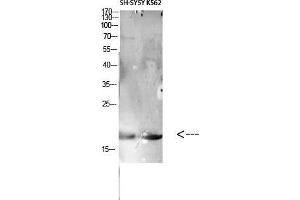 Western Blot (WB) analysis of specific cells using Antibody diluted at 1:1000. (LAIR2 抗体)