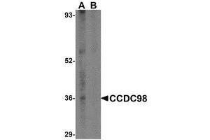 Western blot analysis of CCDC98 in human breast tissue lysate in (A) the absence and (B) presence of blocking peptide with AP30214PU-N CCDC98 antibody at 1 μg/ml. (CCDC98 抗体  (N-Term))
