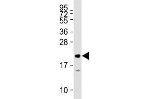 MML2 antibody tested on human recombinant protein at 1:27000. (MLL2 抗体  (AA 4980-5009))