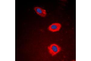 Immunofluorescent analysis of NT5C1B staining in EAhy926 cells. (NT5C1B 抗体  (Center))