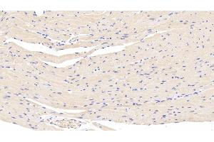 Detection of LEP in Mouse Cardiac Muscle Tissue using Polyclonal Antibody to Leptin (LEP) (Leptin 抗体  (AA 22-167))
