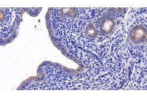 Immunohistochemistry (IHC) image for anti-DEAD (Asp-Glu-Ala-Asp) Box Polypeptide 58 (DDX58) (AA 550-776) antibody (ABIN7433744)