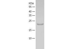 Western Blotting (WB) image for TATA-Binding Protein-Associated Phosphoprotein (DR1) (AA 1-176) protein (His tag) (ABIN7125319) (DR1 Protein (AA 1-176) (His tag))