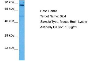 Host: Rabbit Target Name: DLG4 Sample Tissue: Mouse Brain Antibody Dilution: 1ug/ml (DLG4 抗体  (Middle Region))