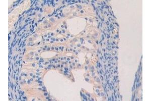 Immunohistochemistry (IHC) image for anti-Laminin, beta 2 (Laminin S) (LAMB2) (AA 1498-1716) antibody (ABIN7438904)