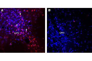 Expression of VGLUT1 in mouse dorsal root nucleus (DRN).