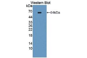 Western blot analysis of the recombinant protein. (TEK 抗体  (AA 44-341))