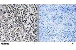 Immunohistochemistry analysis of paraffin-embedded human tonsil tissue using MRPL51 polyclonal antibody . (MRPL51 抗体)