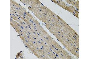 Immunohistochemistry of paraffin-embedded Rat heart using ALDH9A1 Polyclonal Antibody (ALDH9A1 抗体)