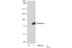 IP Image Immunoprecipitation of Calpain 1 protein from A431 whole cell extracts using 5 μg of Calpain 1 antibody [N3C2], Internal, Western blot analysis was performed using Calpain 1 antibody [N3C2], Internal, EasyBlot anti-Rabbit IgG  was used as a secondary reagent. (CAPN1 抗体)