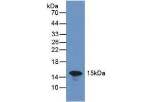Detection of GAL7 in Rat Skin Tissue using Polyclonal Antibody to Galectin 7 (GAL7) (LGALS7 抗体  (AA 1-136))