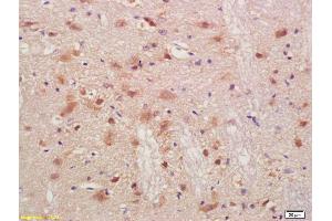 Formalin-fixed and paraffin embedded rat brain labeled with Anti-PMP2 Polyclonal Antibody, Unconjugated (ABIN676823) at 1:200, followed by conjugation to the secondary antibody and DAB staining (PMP2 抗体  (AA 31-132))