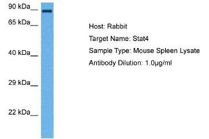 Host: Rabbit Target Name: STAT4 Sample Tissue: Mouse Spleen Antibody Dilution: 1ug/ml (STAT4 抗体  (N-Term))