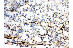 Anti- Versican Picoband antibody, IHC(P) IHC(P): Human Glioma Tissue (Versican 抗体  (N-Term))