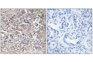 Immunohistochemistry analysis of paraffin-embedded human ovary tissue using CLDN6 antibody. (Claudin 6 抗体  (Internal Region))