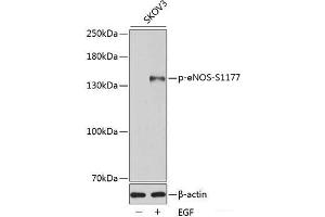 Western blot analysis of extracts of SKOV3 cells using Phospho-eNOS(S1177) Polyclonal Antibody. (ENOS 抗体  (pSer1177))