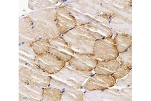 Immunohistochemistry (Paraffin-embedded Sections) (IHC (p)) image for anti-Phosphatidic Acid Phosphatase Type 2 Domain Containing 3 (PPAPDC3) antibody (ABIN7075036)