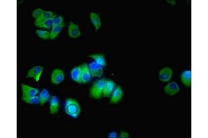 Immunofluorescence (IF) image for anti-Cytochrome P450, Family 17, Subfamily A, Polypeptide 1 (CYP17A1) (AA 24-508) antibody (ABIN7170753)
