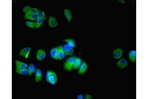 Immunofluorescent analysis of MCF-7 cells using ABIN7170753 at dilution of 1:100 and Alexa Fluor 488-congugated AffiniPure Goat Anti-Rabbit IgG(H+L) (CYP17A1 抗体  (AA 24-508))