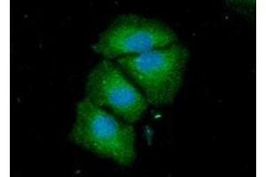 ICC/IF analysis of ACSF2 in HeLa cells line, stained with DAPI (Blue) for nucleus staining and monoclonal anti-human ACSF2 antibody (1:100) with goat anti-mouse IgG-Alexa fluor 488 conjugate (Green) (ACSF2 抗体)