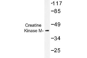Image no. 1 for anti-Creatine Kinase, Muscle (CKM) antibody (ABIN272157) (CKM 抗体)
