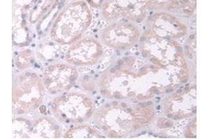IHC-P analysis of Human Kidney Tissue, with DAB staining. (TPMT 抗体  (AA 26-227))