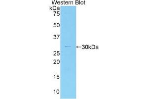 Western blot analysis of the recombinant protein. (MYO1G 抗体  (AA 769-1016))