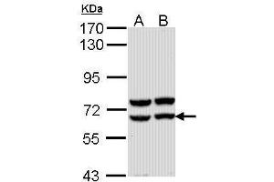 WB Image Sample (30 ug of whole cell lysate) A: Molt-4 , B: Raji 7. (AMY2A 抗体)