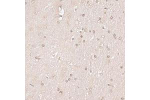 Immunohistochemistry of paraffin-embedded rat brain using HMGN1 antibody. (HMGN1 抗体)