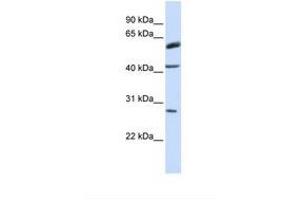 Image no. 1 for anti-Ring Finger Protein 170 (RNF170) (AA 110-159) antibody (ABIN6738072) (RNF170 抗体  (AA 110-159))