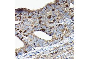 Immunohistochemistry (IHC) image for anti-Protein Regulator of Cytokinesis 1 (PRC1) (AA 351-620) antibody (ABIN6146124)