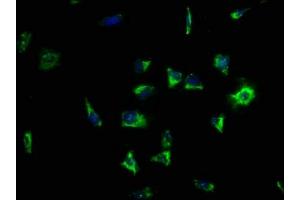 Immunofluorescence staining of SH-SY5Y cells with ABIN7158138 at 1:133, counter-stained with DAPI. (LRRC15 抗体  (AA 301-538))