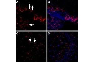Expression of LPA4 receptor in rat and mouse brain - Immunohistochemical staining of rat choroid plexus and mouse hippocampal CA3 region using Anti-LPAR4 (P2Y9) (extracellular) Antibody (ABIN7043315, ABIN7044572 and ABIN7044573), (1:400). (LPAR4 抗体  (Extracellular))