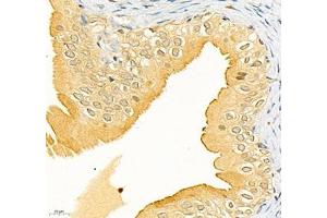 Immunohistochemistry (Paraffin-embedded Sections) (IHC (p)) image for anti-Carcinoembryonic Antigen-Related Cell Adhesion Molecule 1 (CEACAM1) antibody (ABIN7073315)