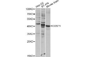 Western blot analysis of extracts of various cell lines, using DUSP1 Antibody (ABIN1872372) at 1:300 dilution. (DUSP1 抗体)