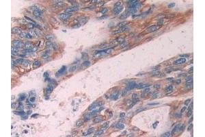 Immunohistochemistry (IHC) image for anti-Keratin 6C (KRT6C) (AA 163-482) antibody (ABIN7443299)
