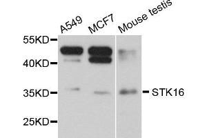Western blot analysis of extract of various cells, using STK16 antibody. (STK16 抗体)
