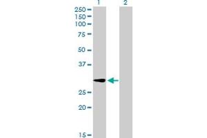 Western Blot analysis of GALNT12 expression in transfected 293T cell line by GALNT12 MaxPab polyclonal antibody. (GALNT12 抗体  (AA 1-272))
